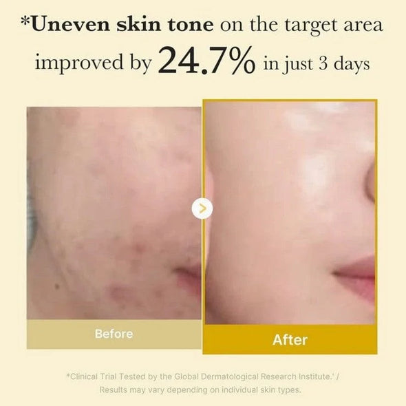 Medicube Kojic Acid Turmeric Night Wrapping Mask/ماسك النوم بالكركم و حمض الكوجيك