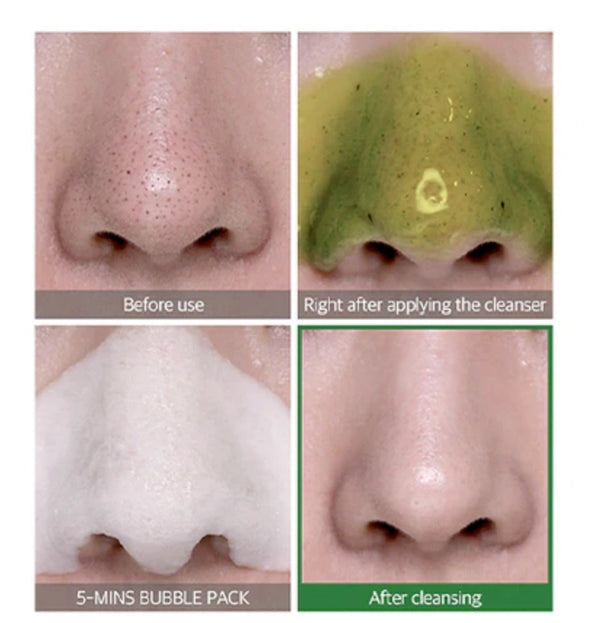 Bye Bye Blackhead 30 Days Miracle Green Tea Tox Bubble Cleanser Price in Oman