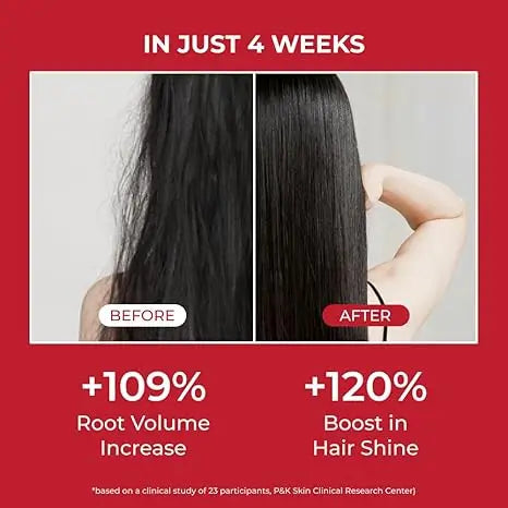 MOEV Annurcatin Shampoo / شامبو بالكافيين و البايوتين لتحفيز نمو الشعر