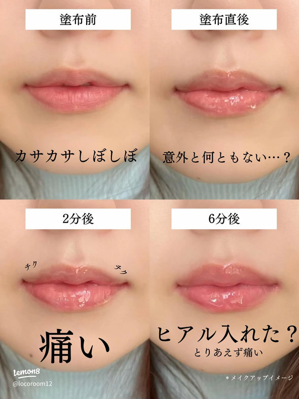 VT Reedle Shot Lip Plumper Expert/ لشفاه ممتلئة