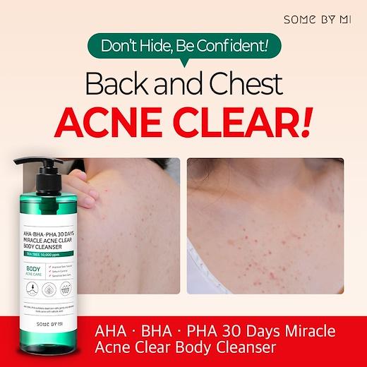 AHA.BHA.PHA 30 Days Miracle Acne Clear Body Cleanser - Glowup Oman